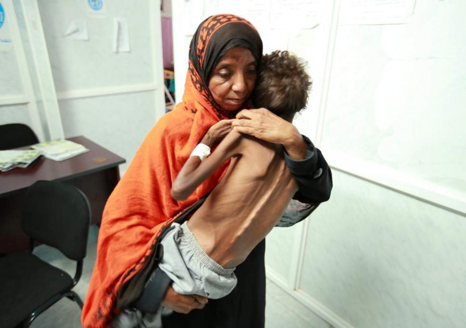Στα πρόθυρα λιμού η Υεμένη