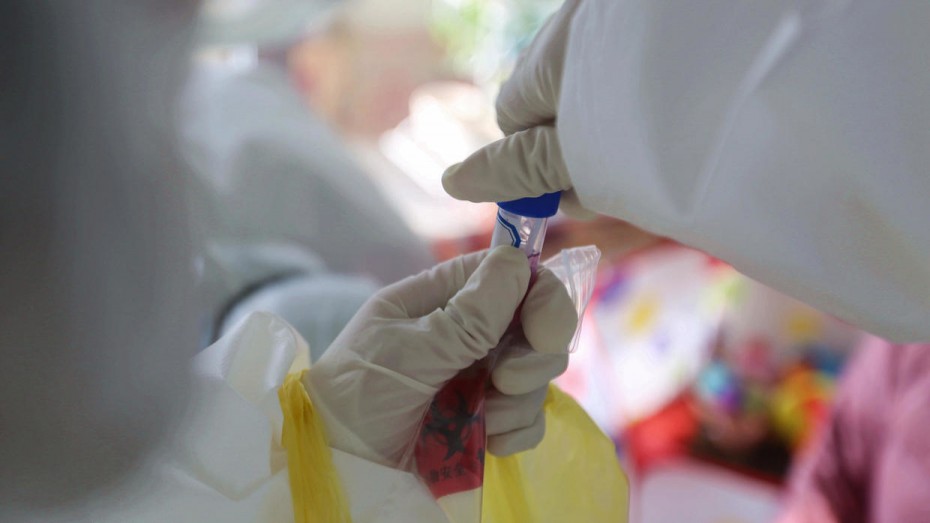 Η Ρωσία έτοιμη να συμβάλει στην παρασκευή του εμβολίου κατά του κοροναϊού