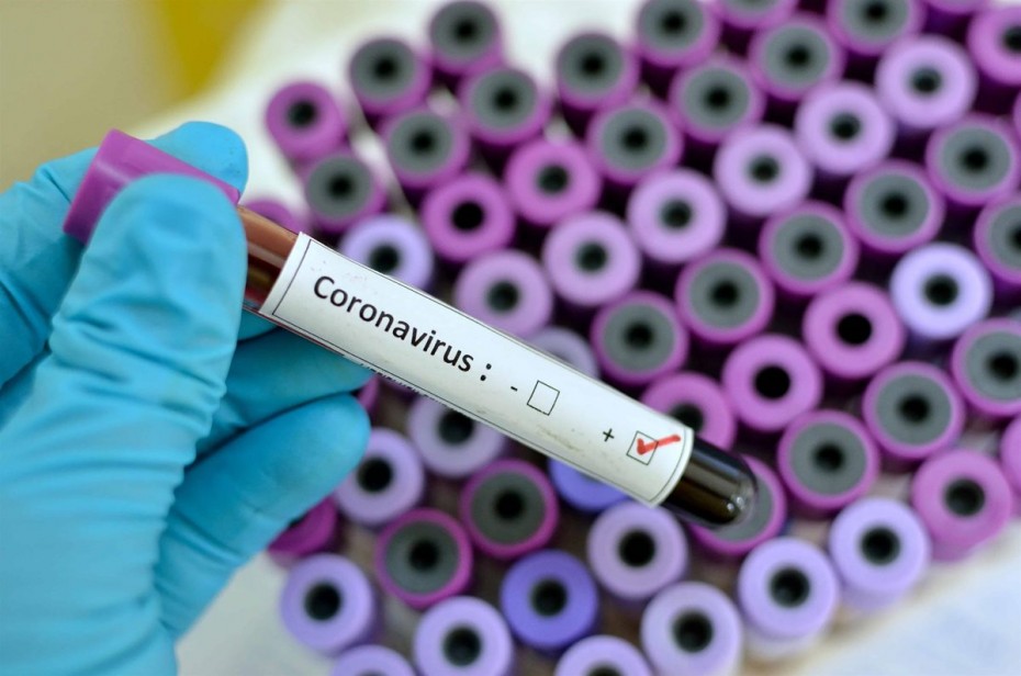 Κορονοϊός: Στην τελική φάση εμβόλιο αμερικανικής εταιρείας