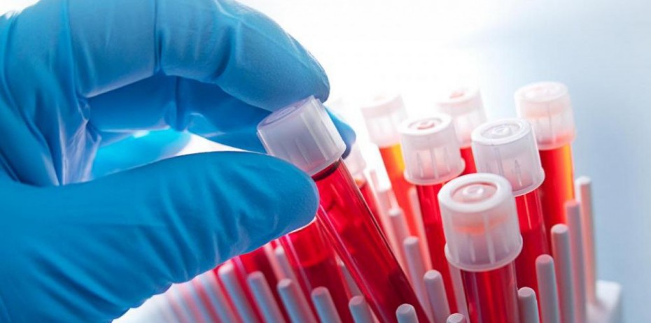 Ξεκινά η μεγαλύτερη παγκοσμίως δοκιμή ανίχνευσης 50 ειδών καρκίνου πριν την εμφάνιση συμπτωμάτων με τεστ αίματος 